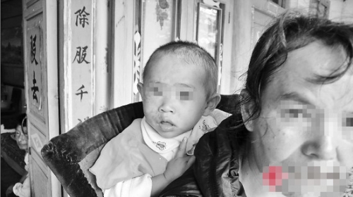 弥渡县女子患精神病划伤一岁半女儿半边脸